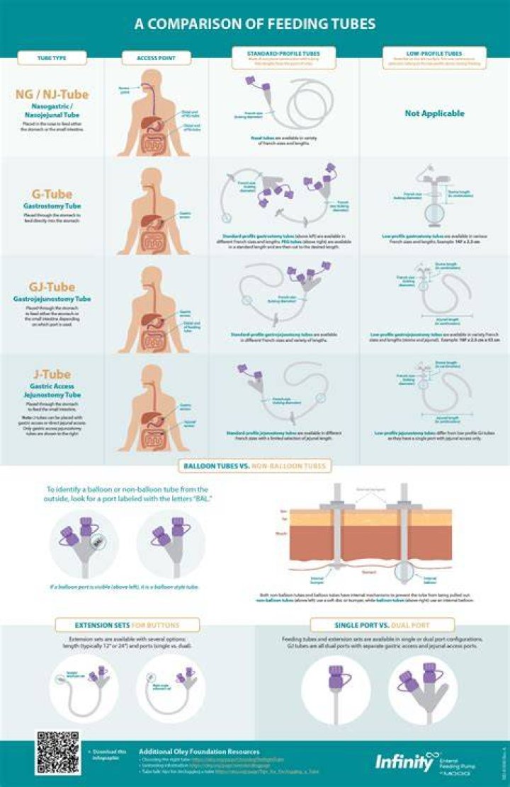 Are feeding tubes safe?