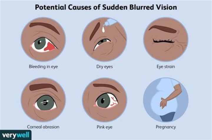 Can a panic attack cause temporary blindness?