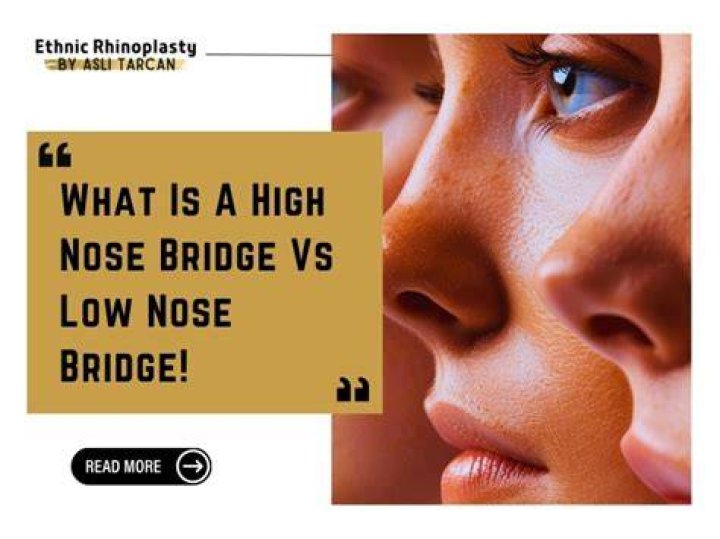 Do i have a high nose bridge?
