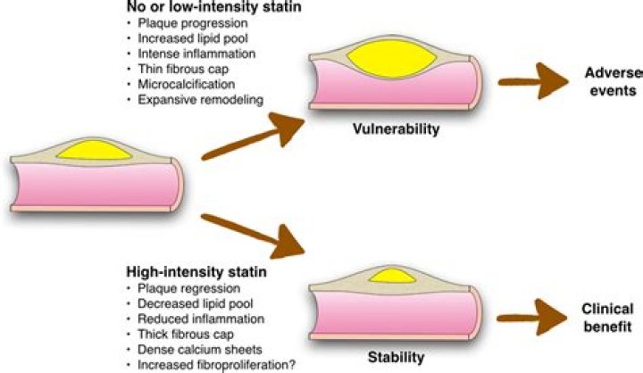 Do statins help calcification?