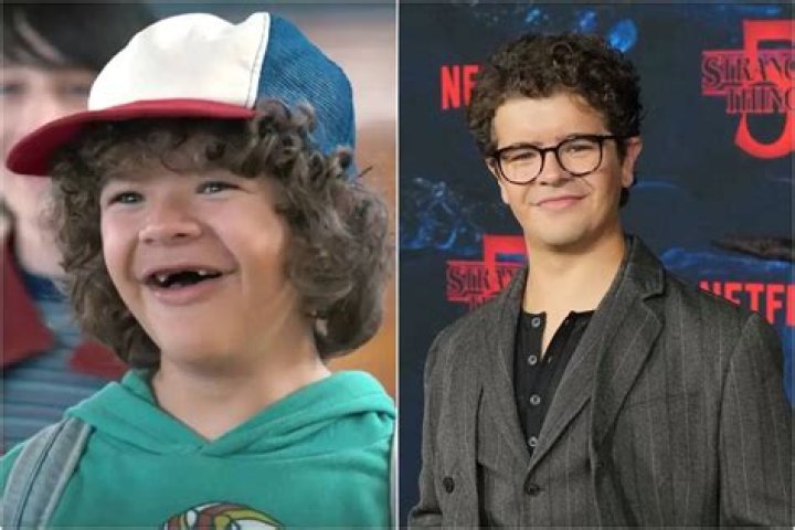 Does Dustin from Stranger things have Down syndrome?