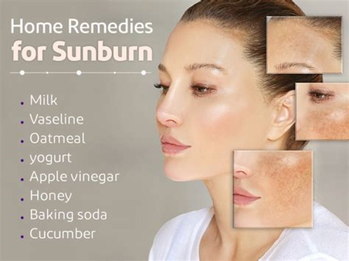 Does sorbolene cream help with sunburn?