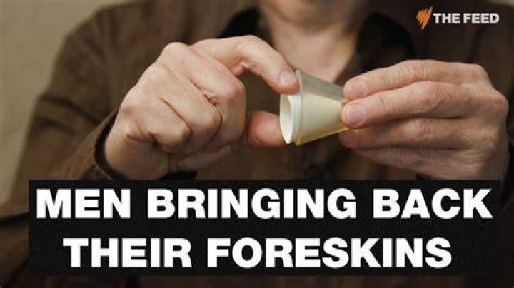 Has anyone died from circumcision?