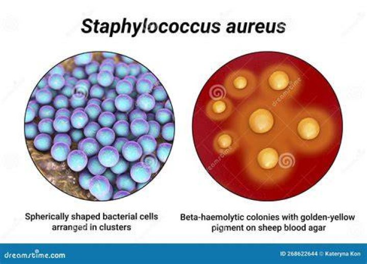What does aureus mean in english?