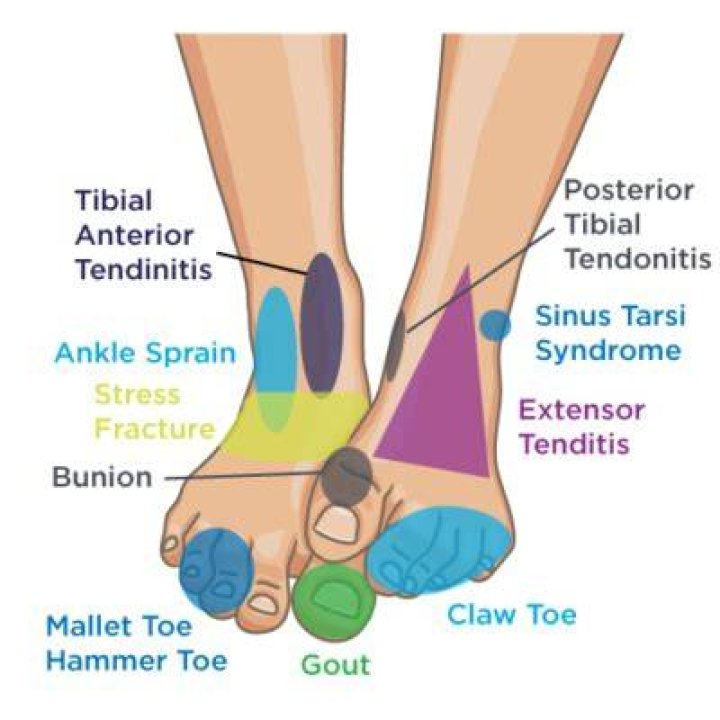 What does front foot mean?