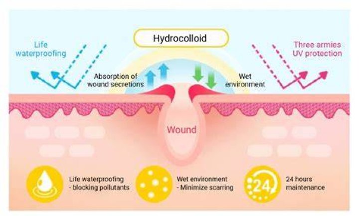 What does hydrocolloid do?