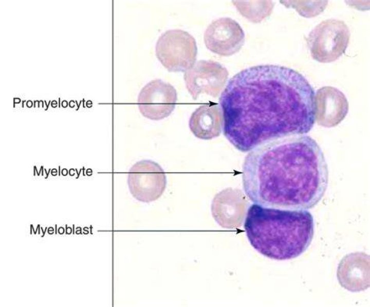 What does myeloblast mean?
