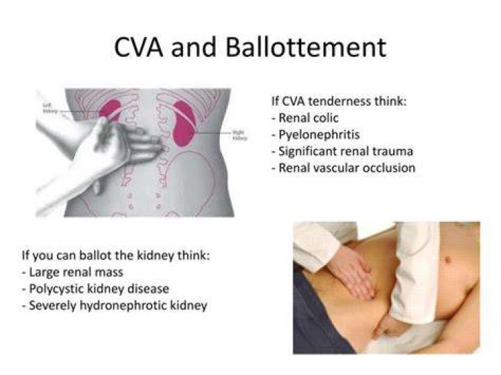 What is ballotable kidney?