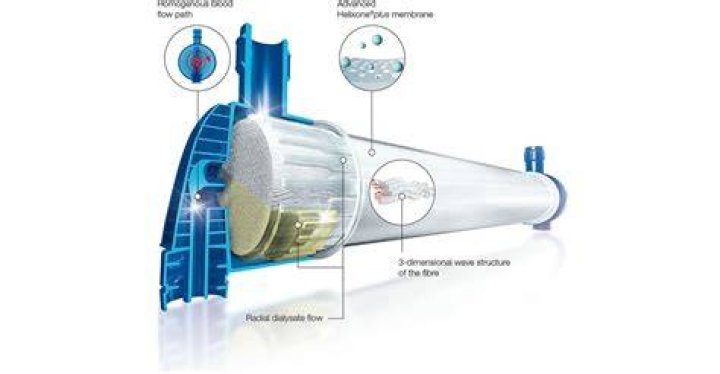What is dialyzer surface area?