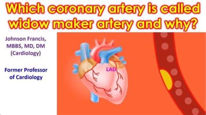 What is widow maker artery?