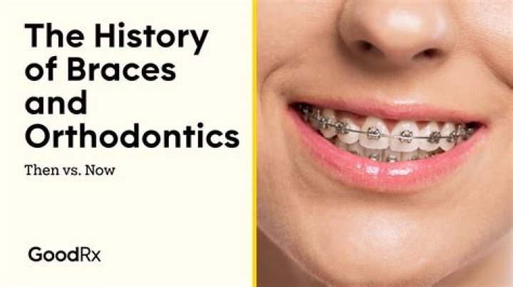 When did orthodontic start?