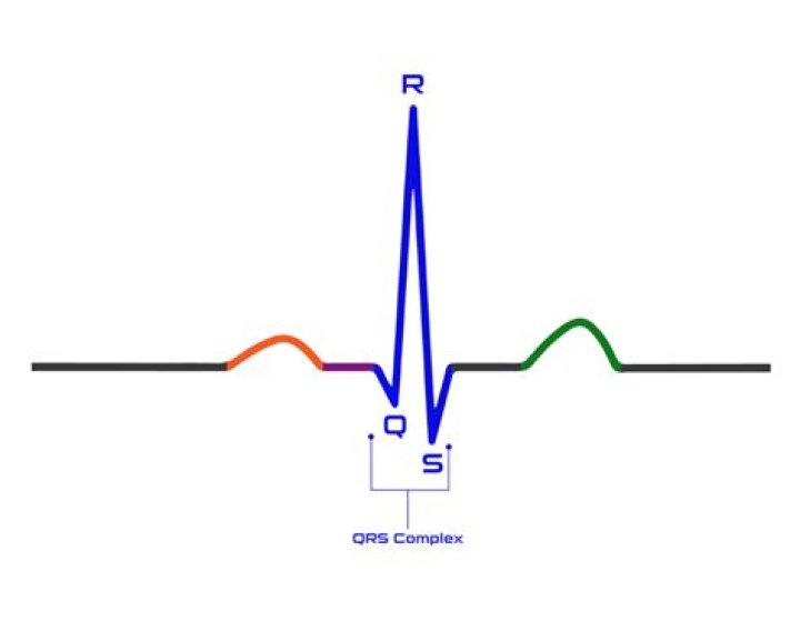 Why does QRS complex have the largest amplitude?