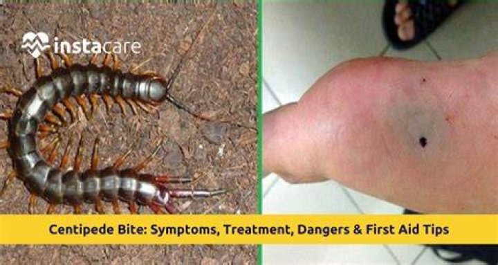 Will a centipede sting you?